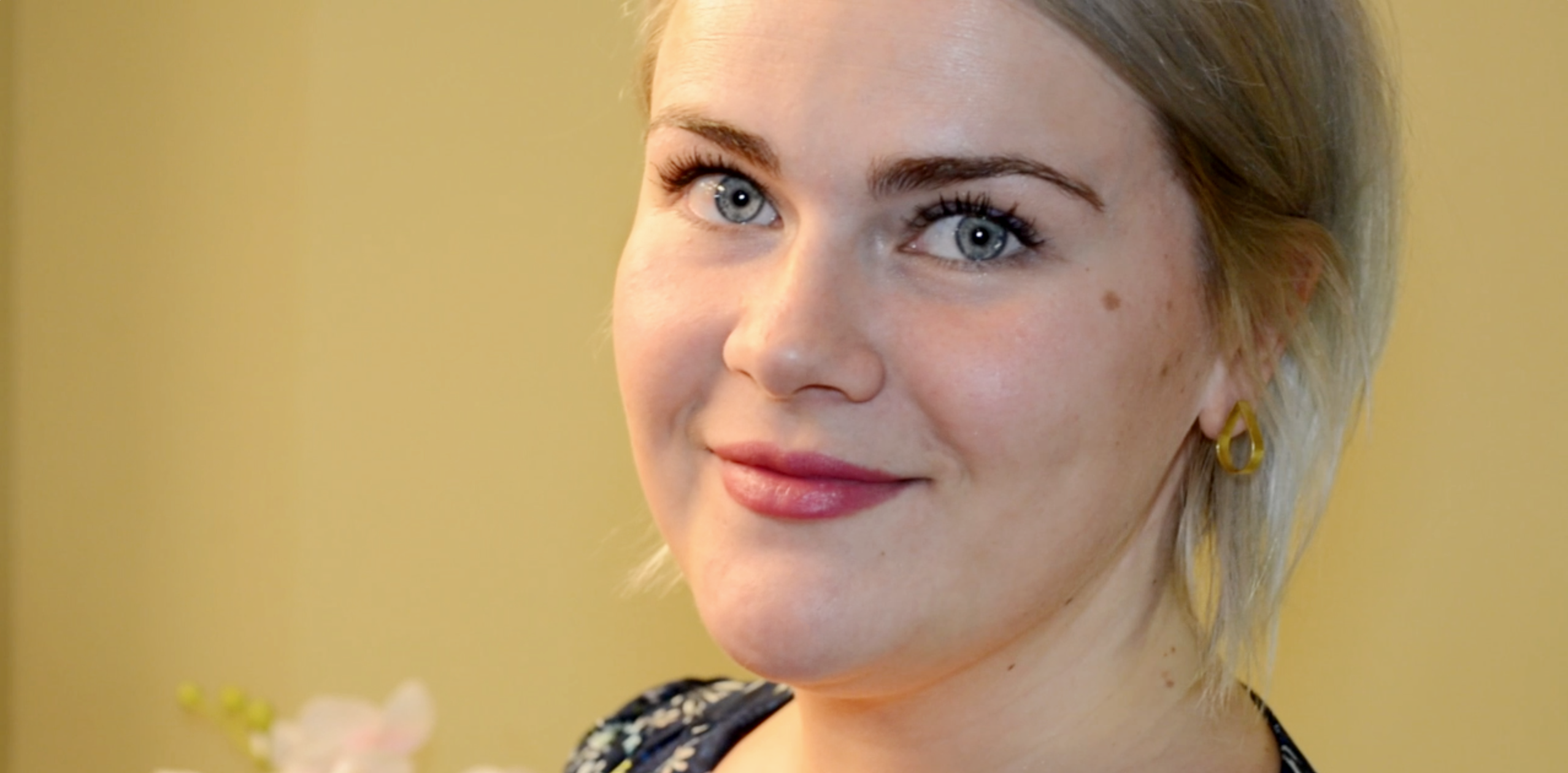 huulte täitesüst medemis kliinik